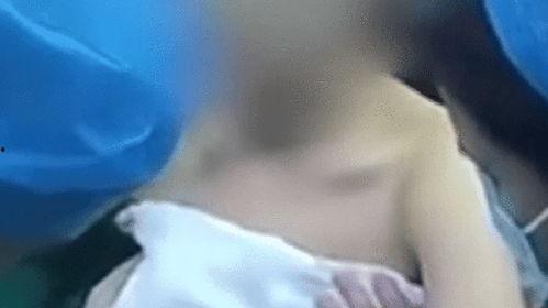 观看乳房视频,全面了解乳腺知识
